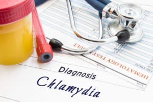 diagnosis of STDs disease Chlamydia